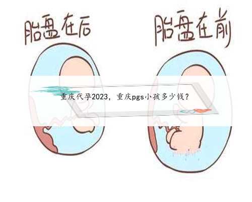 重庆代孕2023，重庆pgs小孩多少钱？